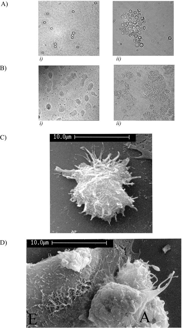 Acanthamoeba