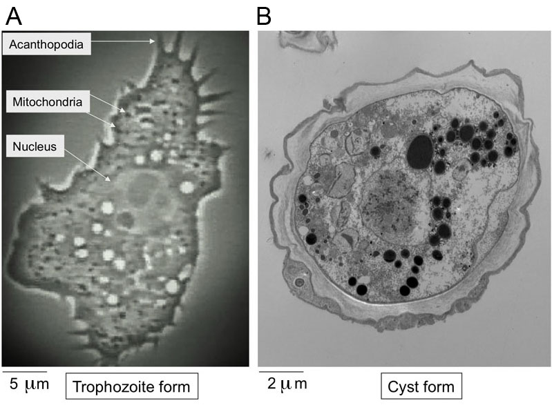 Acanthamoeba