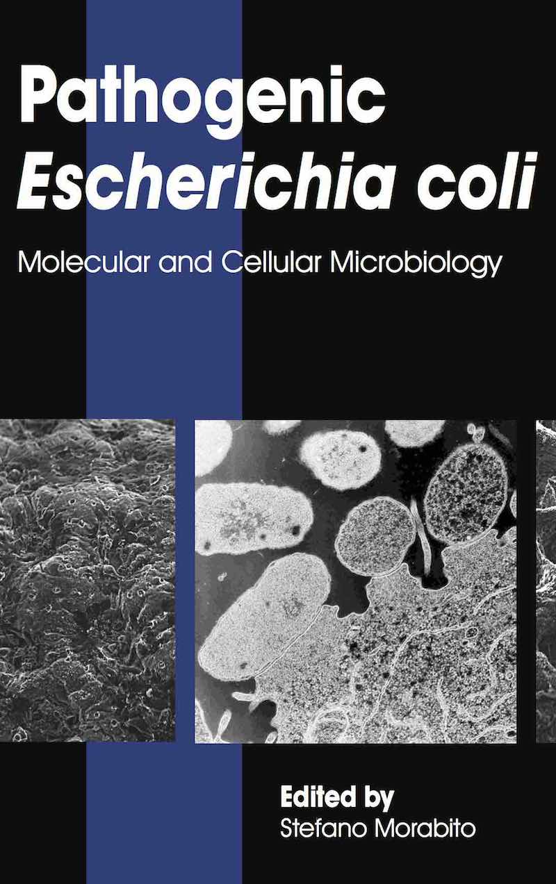 Pathogenic Escherichia coli: Molecular and Cellular Microbiology
