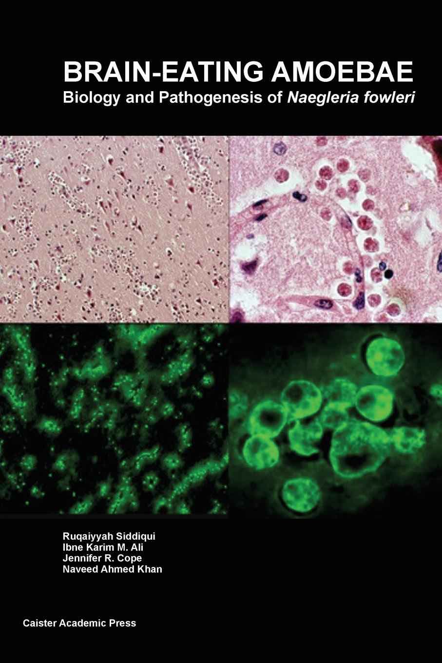 Brain-eating Amoebae: Biology and Pathogenesis of Naegleria fowleri