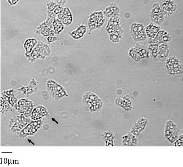 Acanthamoeba