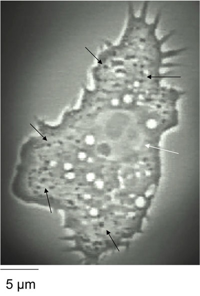 Acanthamoeba