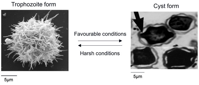 Acanthamoeba