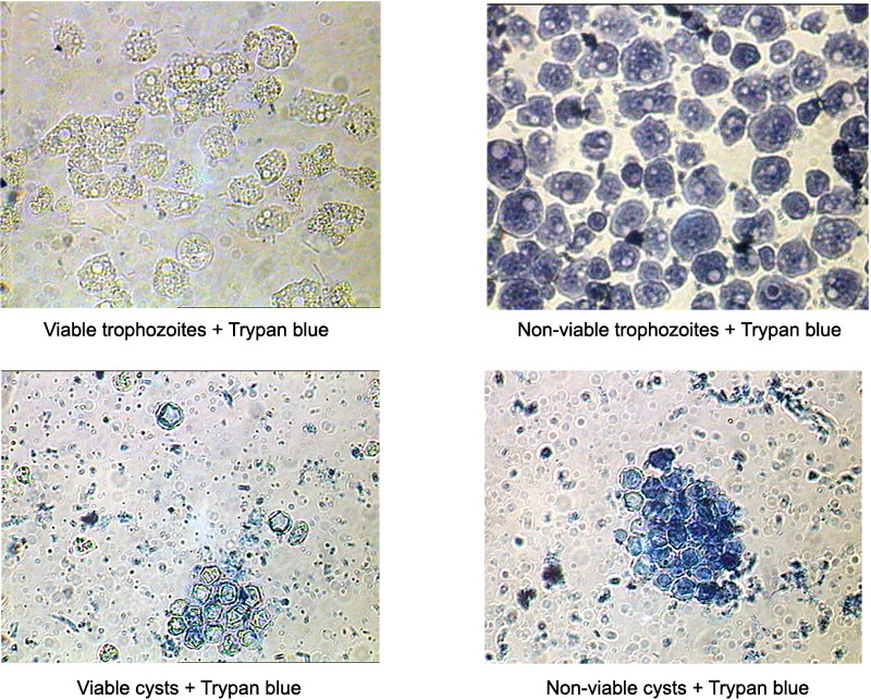 Acanthamoeba