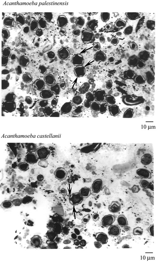Acanthamoeba