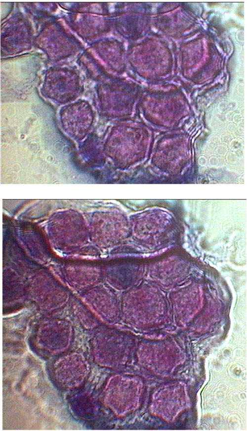 Acanthamoeba