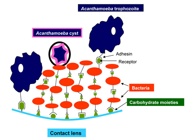 Acanthamoeba