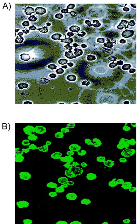 Acanthamoeba