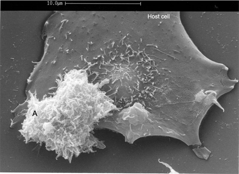 Acanthamoeba