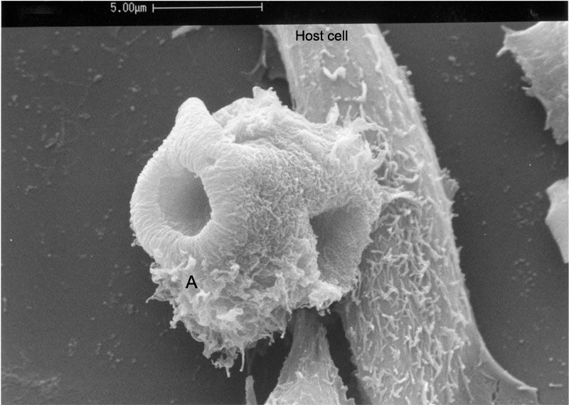 Acanthamoeba