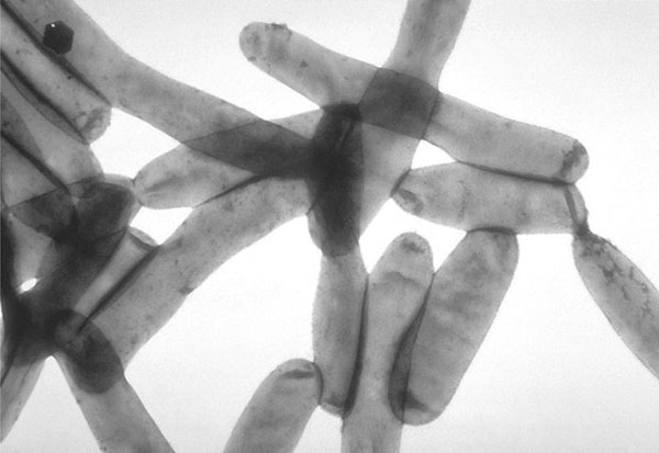 Acanthamoeba